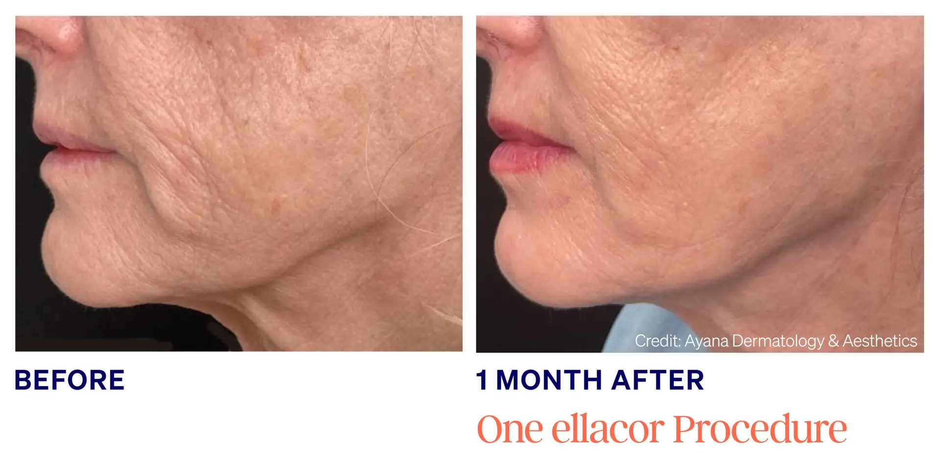 Ayana Dermatology-Female