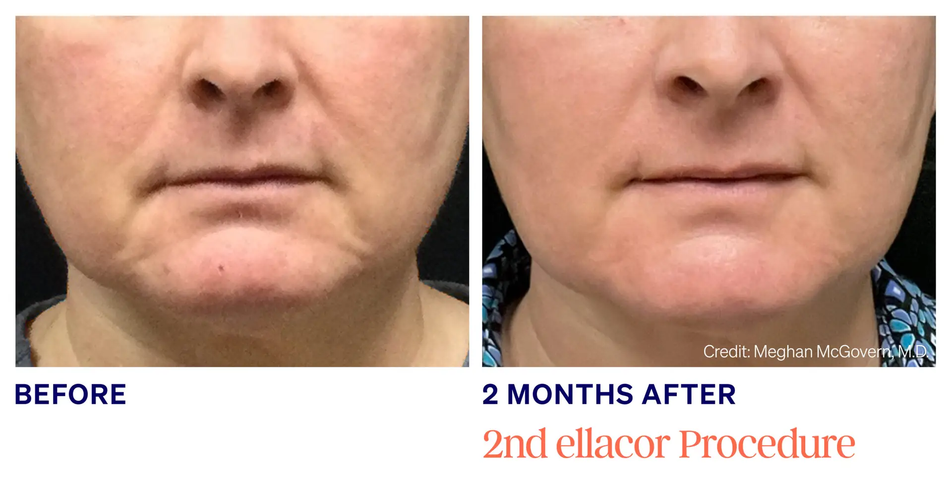 McGovern-Female (low res)